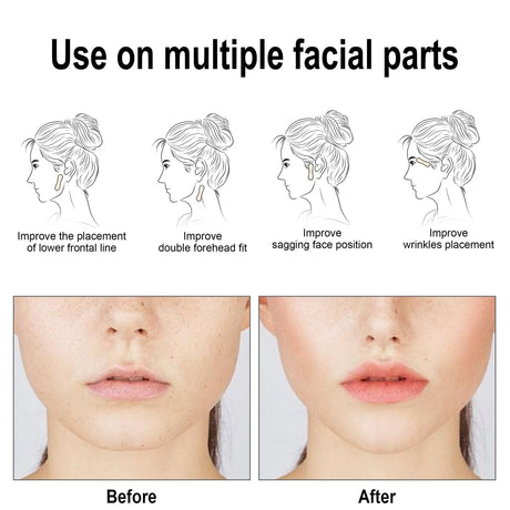 Facial Lifting Patch, Lift Face Double Chin V Face Melon Seed Face Invisible Lifting Patch - V.I.P Digital Presence