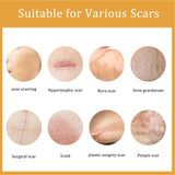 Desalting Skin Scar Cream, Skin Burn Scalding Surgical Scar Wound Repair Cream - V.I.P Digital Presence