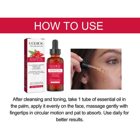 Rose Hip Facial Essential Oil Facial Body Moisturizing Skin care Supple Hair Care Massage Essential Oil - V.I.P Digital Presence