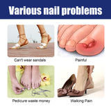 Nail Repair Solution Gentle Clean, Moisturize, Moisturize And Nourish Nails And Nails