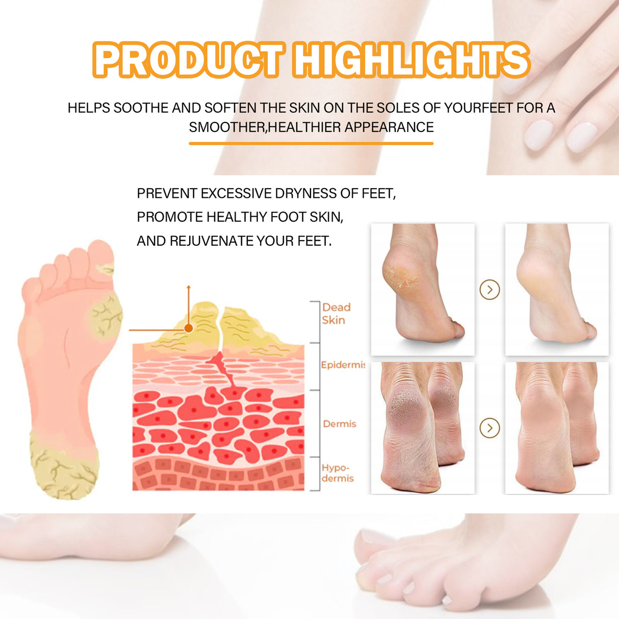 Foot Calluses Moisturizing Spray, Repair Heel Calluses, Remove Dead Skin, Moisturize And Moisturize Foot Care - V.I.P Digital Presence