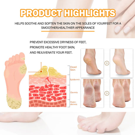 Foot Calluses Moisturizing Spray, Repair Heel Calluses, Remove Dead Skin, Moisturize And Moisturize Foot Care - V.I.P Digital Presence