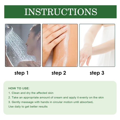 Psoriasis Cream, Relieve Itchy Skin Of Hands And Feet Skin Moss Body Skin Care Cream - V.I.P Digital Presence