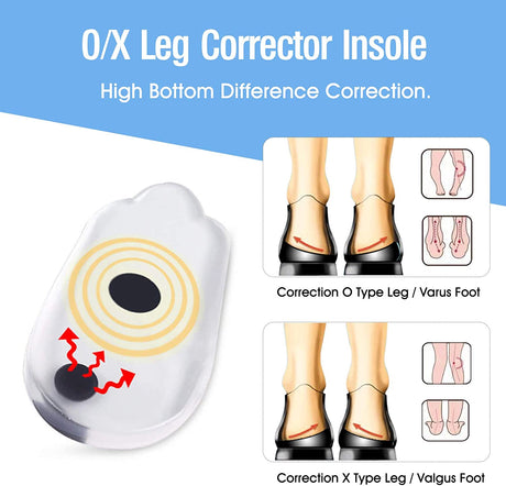 2PCS Insoles Correction Shoe Inserts Pads Effective O/X Type Leg Bowed Legs Knee Valgum Straightening for Women Men Health Care - V.I.P Digital Presence