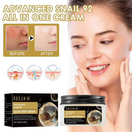 Advanced Snail 92 All In One Cream, Brightening And Firming Skin Face Cream With Moisturizing Moisturizing Moisture - V.I.P Digital Presence