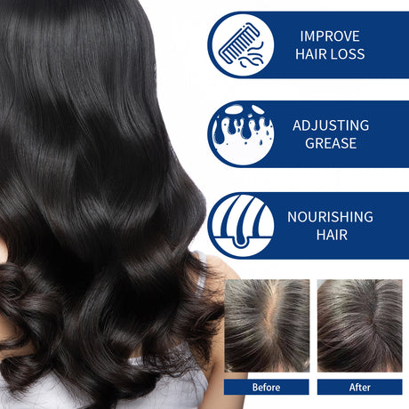 Hair Scrub Cleans Scalp Dandruff, Soothes Itchiness, Moisturizes Dense, Firming, And Prevents Hair Loss - V.I.P Digital Presence