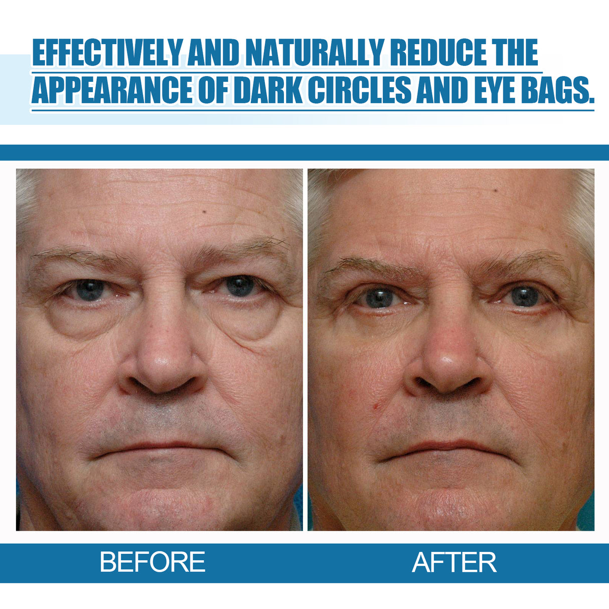 Men's Eye Serum Reduces Fine Lines, Bags, Dark Circles, Moisturizes, Firming, Brightening And Anti-Aging Eye Area - V.I.P Digital Presence