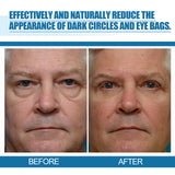 Men's Eye Serum Reduces Fine Lines, Bags, Dark Circles, Moisturizes, Firming, Brightening And Anti-Aging Eye Area - V.I.P Digital Presence