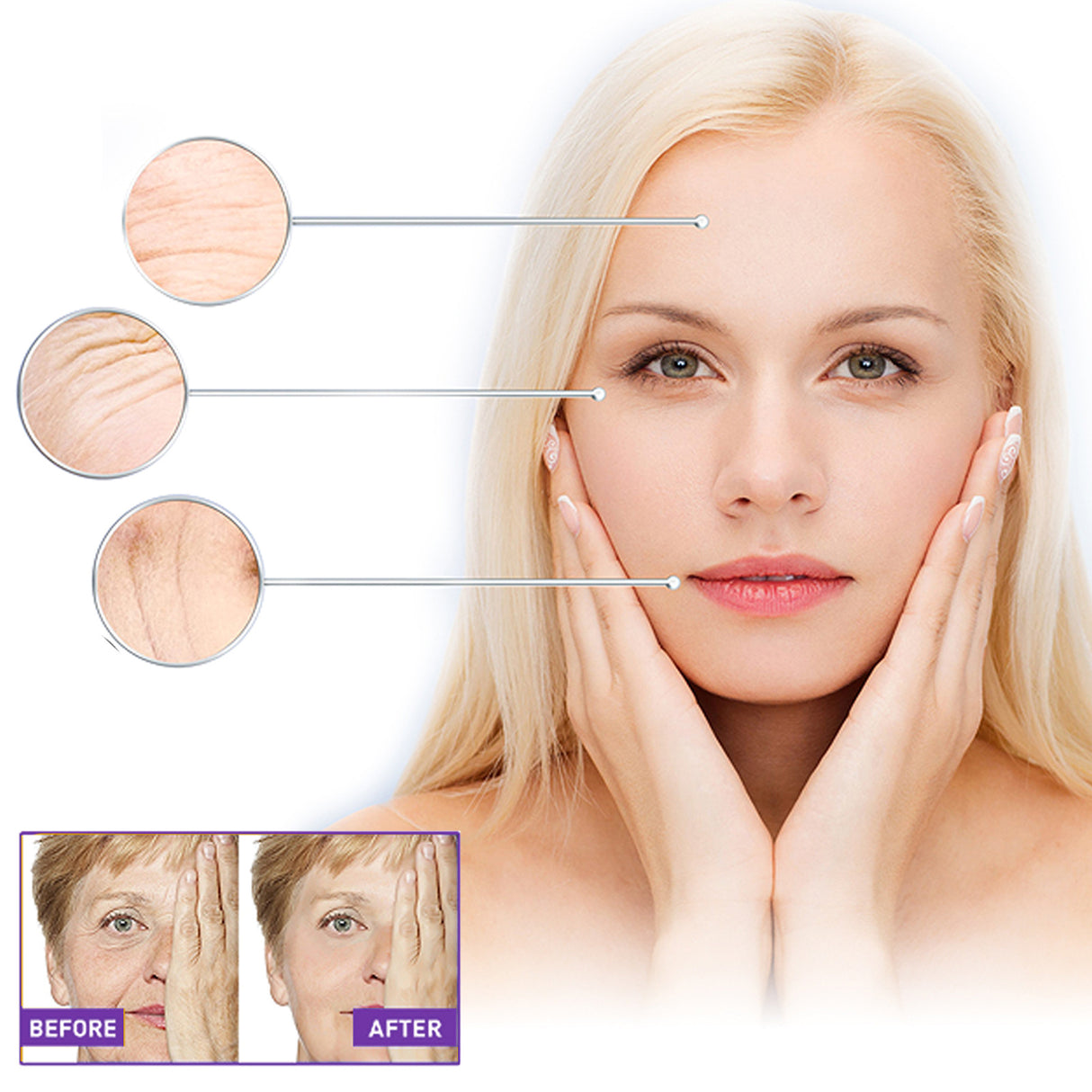 Facial Wrinkle Patch, Droop Decree Line Lift Facial Skin Tightens Mouth Line Cheek Patch