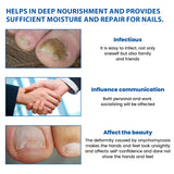 Nighttime Renewal Fungal Nail Patches, Repair And Thickening Gray Nail Insert Soft Nail Care Patch - V.I.P Digital Presence