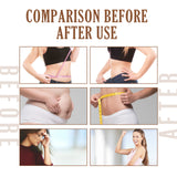 Is Beautiful And Considerate, Tightens The Whole Body Skin, Shows The Figure Body Care Light Body Navel Patch