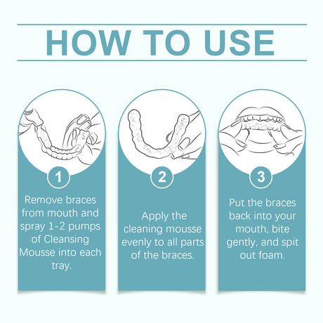 Braces Cleansing Mousse, Teeth And Mouth Fresher Corrector Gentle Cleansing Foam - V.I.P Digital Presence