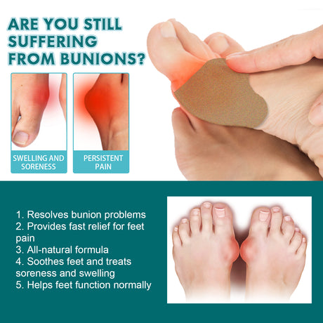 Bunion Patch, Relieves Toes Swelling And Pain Corrects Thumb Valgus Herbal Care Patch - V.I.P Digital Presence