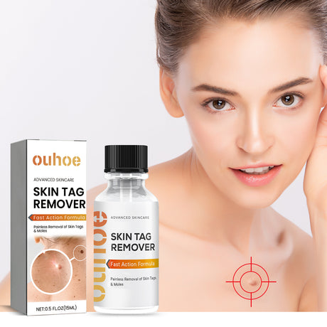 Anti-wart Essence, Anti Warts Fade Moles Corns Smoothing Skin Care Essence - V.I.P Digital Presence
