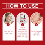 Rosehip Seed And Wart Essence Oil, Moisturizes And Restores Smooth Skin - V.I.P Digital Presence