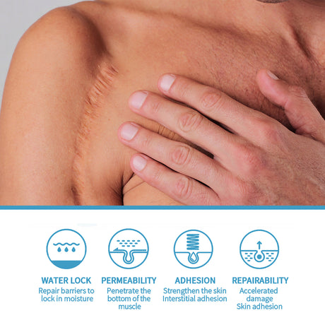 Scar Repair Serum Lightens Post-Pregnancy Scar Repair And Smoothes Body Skin - V.I.P Digital Presence