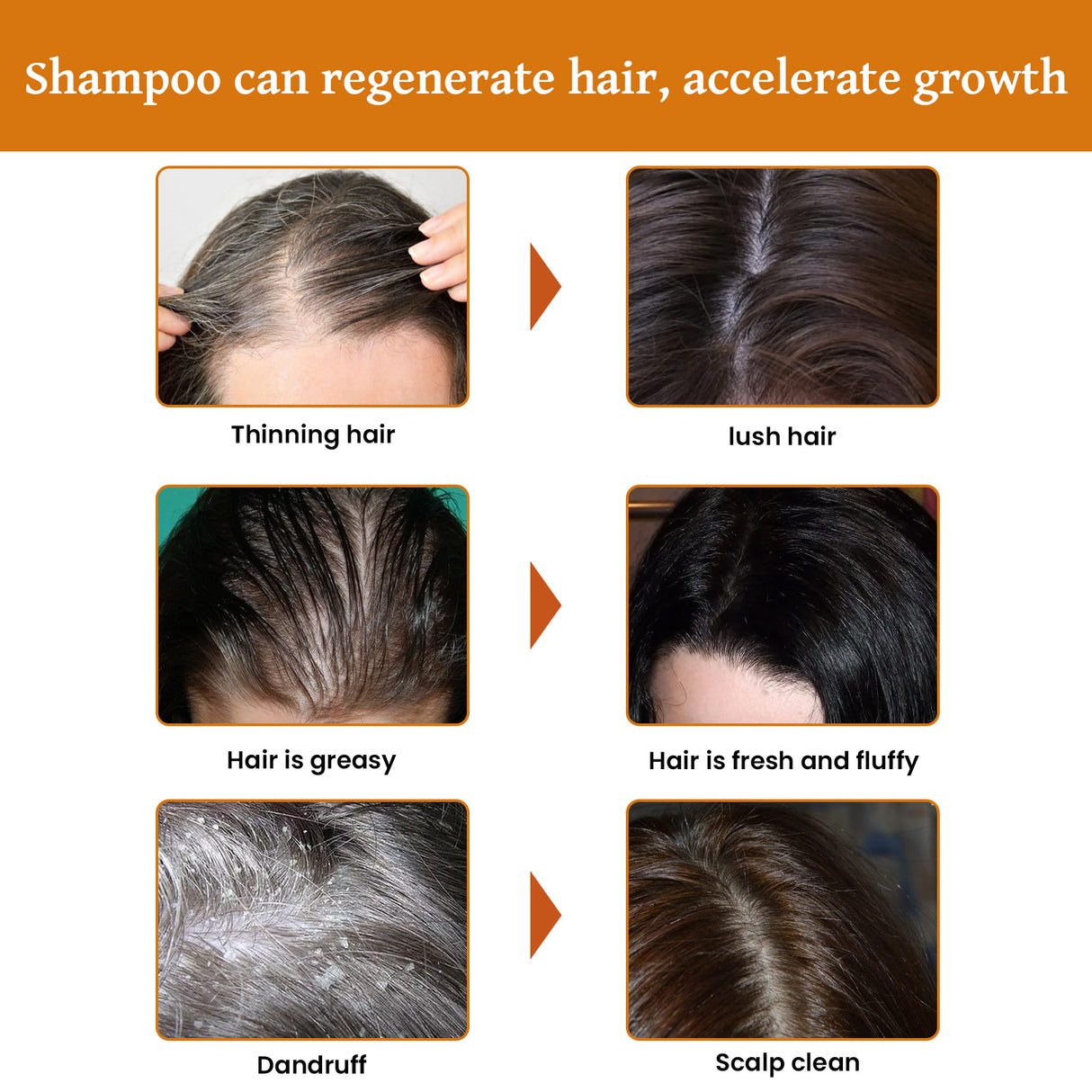 Rice Dense Hair Shampoo Deep Clean Thick Hair Moisturizing Hair Root Solid Hair Care Shampoo - V.I.P Digital Presence