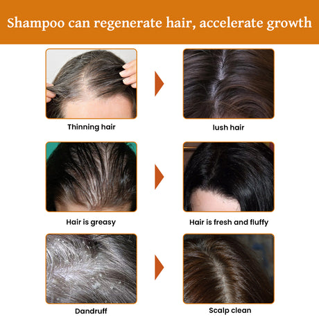 Rice Dense Hair Shampoo Deep Clean Thick Hair Moisturizing Hair Root Solid Hair Care Shampoo - V.I.P Digital Presence