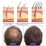 Men's Dense Hair Foam Machine, Repair Hair Root Follicle Men's Hair Thick Moisturizing Foam - V.I.P Digital Presence