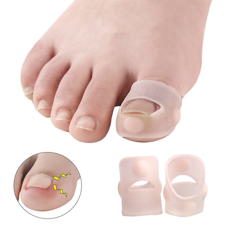 Silicone Inlay Nail Corrector Roll Nail To Correct Nail Pad Nail Groove And Toe To Prevent Nails From Growing Into Flesh - V.I.P Digital Presence