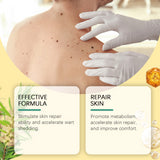 Bee Venom Wart & Mole Removal Spray, Gentle Cleansing Skin Moisturizing Moisturizing Smooth Skin Care - V.I.P Digital Presence