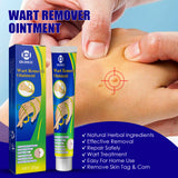 Wart Remover Ointment, Remove Hou Warts Flat Corn Plaster Flat Grains Warts, Foot And Repair Skin Dot Mole G Wart Cream - V.I.P Digital Presence
