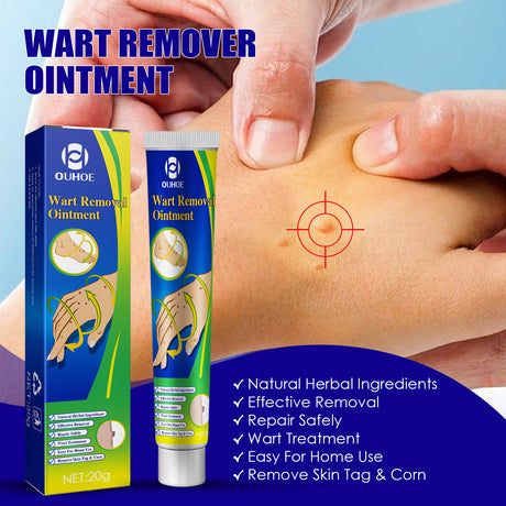 Wart Remover Ointment, Remove Hou Warts Flat Corn Plaster Flat Grains Warts, Foot And Repair Skin Dot Mole G Wart Cream - V.I.P Digital Presence
