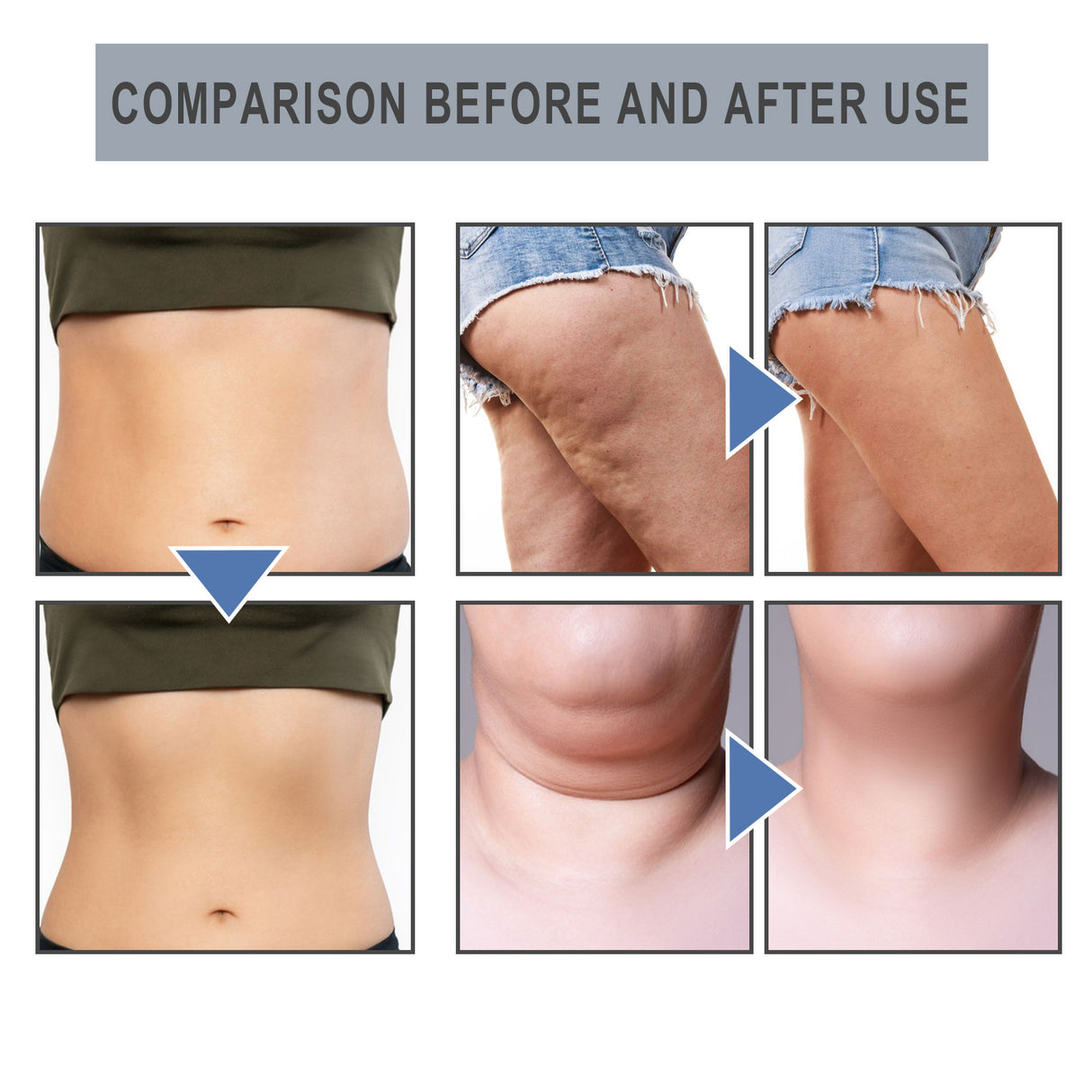 Slimming Essential Oil Nose Ring Tightens Curves And Reduces Belly Fat Shaping Essential Oil Ring Tightens Skin