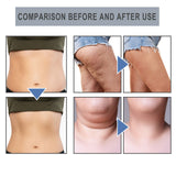 Slimming Essential Oil Nose Ring Tightens Curves And Reduces Belly Fat Shaping Essential Oil Ring Tightens Skin