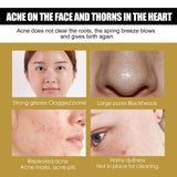 Advanced Snail 92 All In One Cream, Brightening And Firming Skin Face Cream With Moisturizing Moisturizing Moisture - V.I.P Digital Presence