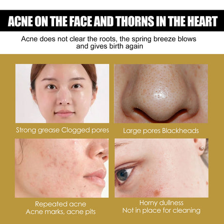 Advanced Snail 92 All In One Cream, Brightening And Firming Skin Face Cream With Moisturizing Moisturizing Moisture - V.I.P Digital Presence