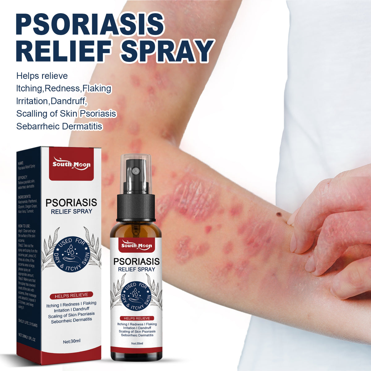 Psoriasis Relief Spray, Relieve Skin, Hands And Feet Redness Peeling Itch Repair External Care - V.I.P Digital Presence