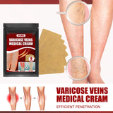 Aricose Veins Medical Cream, Relieve Leg Swelling Earthworm Leg Vein Massage To Relieve Pain - V.I.P Digital Presence