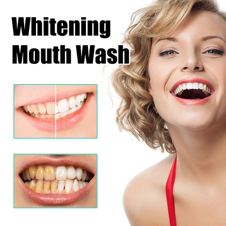 Whitening Mouth Wash, Beauty Shine White Teeth And Fresh Breath Odor Clean Mouth Care Gums - V.I.P Digital Presence