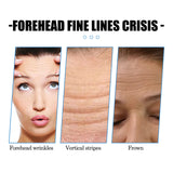 Forehead Care Patch Reduces Raised Head Lines, Firming Skin, Hydrating And Smoothing Skin Patch - V.I.P Digital Presence