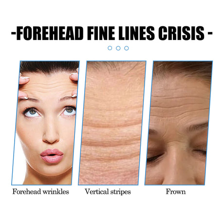 Forehead Care Patch Reduces Raised Head Lines, Firming Skin, Hydrating And Smoothing Skin Patch - V.I.P Digital Presence