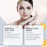 Acne Soothing Serum Facial Skin Hydrating And Moisturizing Pitted And Pimple Mild Care Solution