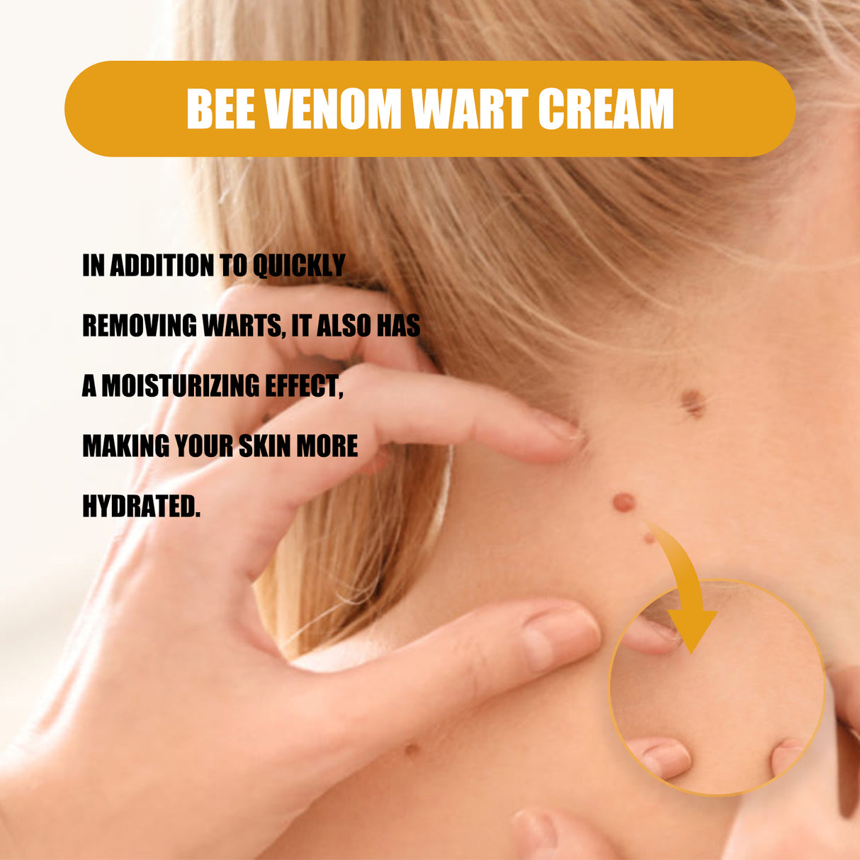Bee Venom Wart Cream, Repair Smooth Skin Lightening Nevus Spot Nevus Cure Wart Care Cream - V.I.P Digital Presence