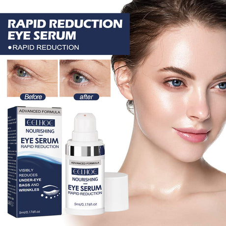 Eye Repair Essence Moisturizes, Hydrates And Lightened Eye Lines, Strengthens, Lifts And Smooths Fine Lines - V.I.P Digital Presence