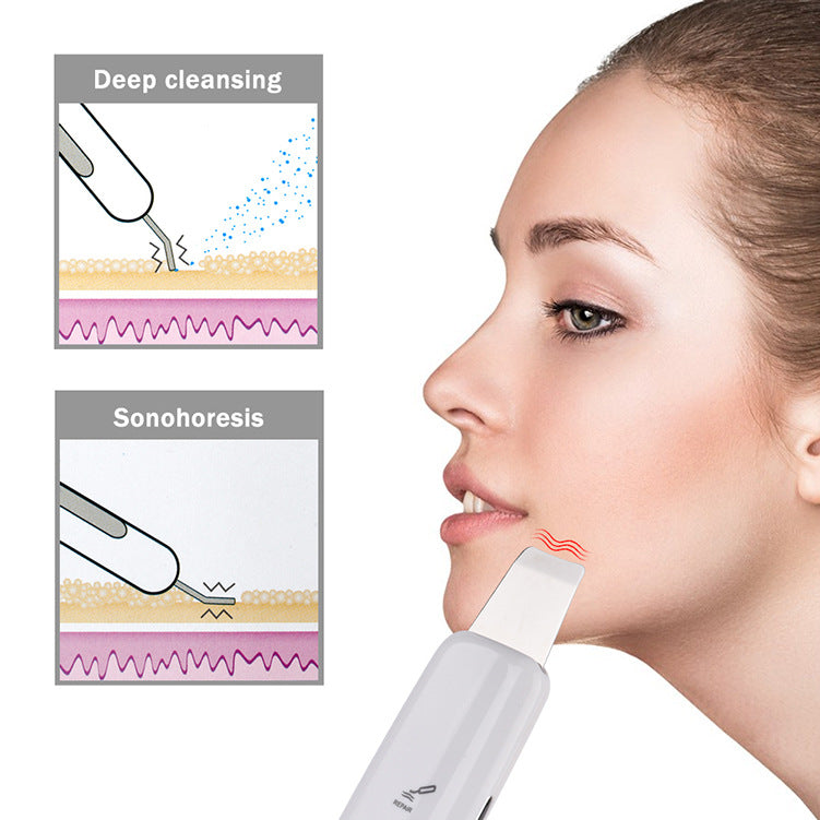 HailiCare Facial Ultrasonic Peeling Machine Deep Cleans Dead Skin Cleansing Machine to Remove Blackheads - V.I.P Digital Presence