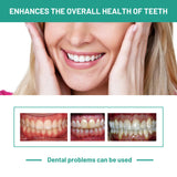 Probiotics Bright Whitening Teeth Mousse, Clean Mouth Odor Tartar Very Well To Protect The Gum Beautiful White Teeth - V.I.P Digital Presence