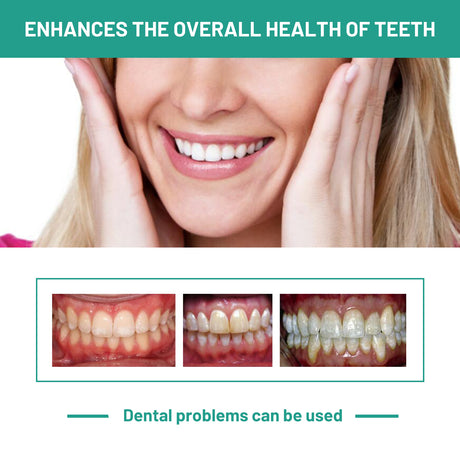 Probiotics Bright Whitening Teeth Mousse, Clean Mouth Odor Tartar Very Well To Protect The Gum Beautiful White Teeth - V.I.P Digital Presence