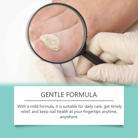 Nail Repair Oil Clean, Nourish And Gently Repair Hands, Feet And Nails Glossy Foot Nail Repair Oil - V.I.P Digital Presence