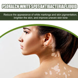 White Spot Purifying Serum For Whitening And Repairing White Spot Spot And Perspiration Spot Skin Moisturizing Serum - V.I.P Digital Presence