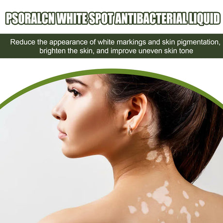 White Spot Purifying Serum For Whitening And Repairing White Spot Spot And Perspiration Spot Skin Moisturizing Serum - V.I.P Digital Presence