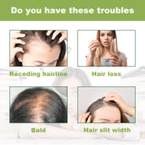 Rosemary Dense Hair Spray Hydrates Roots For Increased Elasticity Restoring Shine Anti-Set Hair Spray - V.I.P Digital Presence