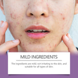 Multicolor Invisible Acne Patch Clear Acne Remove Acne Skin Care Facial Cover Acne Marks