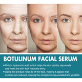 B5 Face Capsule Essence Reduces Fine Lines, Lifts Sagging, Firming And Moisturizing Face