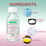 Salicylic Acid Acne Drying Lotion, Gentle Repair Acne-Skin Skin Moisturizing Lotion - V.I.P Digital Presence