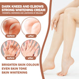 Joint Whitening Cream, Moisturizes Dull Skin Whitening Repair Cream For Joints And Elbows - V.I.P Digital Presence